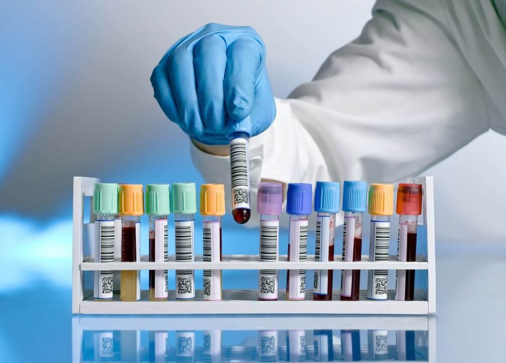 tes darah untuk pelepasan patologis selama gairah