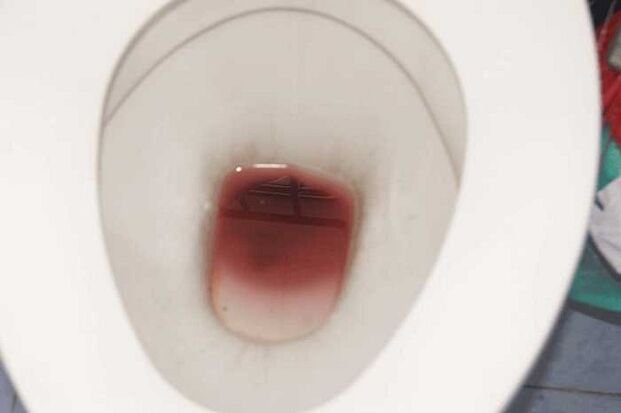 bercak pada pria saat bersemangat